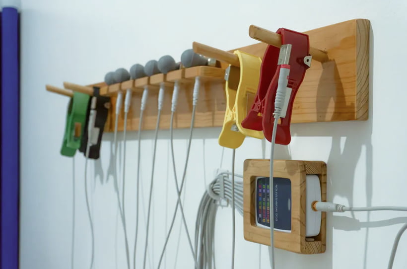 Electrocardiograma (ECG o EKG)